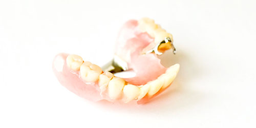 ようこう歯科の歯が抜けた場合の治療の説明(入れ歯)
