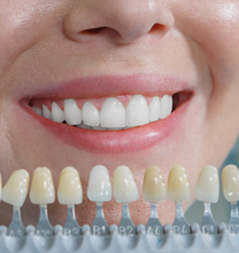 ようこう歯科のお悩み別治療法「歯を白くしたい」