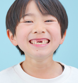 ようこう歯科のお悩み別治療法「お子様の歯」