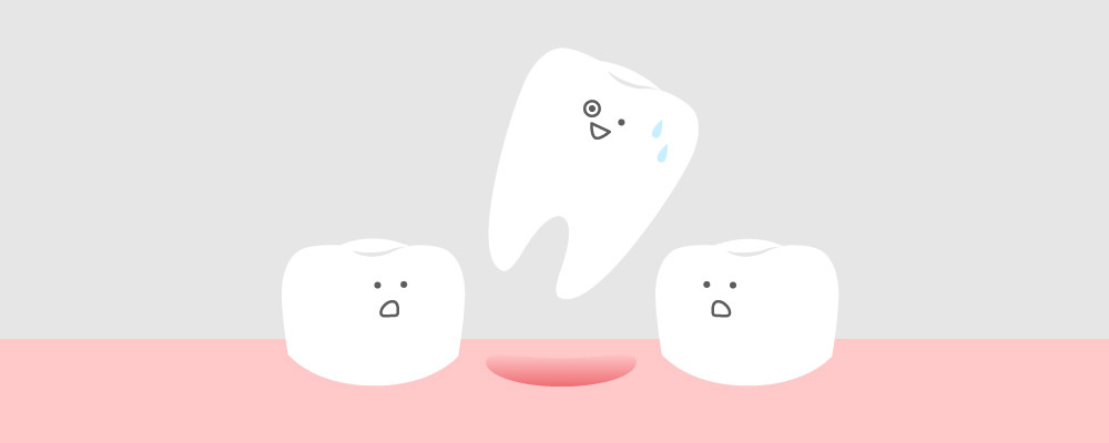 ようこう歯科の歯が抜ける原因の解説